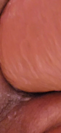 Huge Asspussy Gape with Help From 9.5 in. Circumference King Cock Chubby!