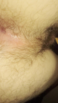 Close up of My Hole