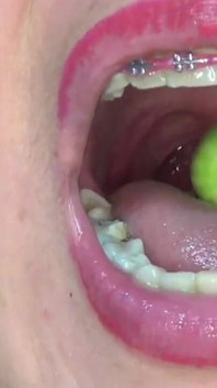 Impressive!! I Play and Swallow Huge Round Candies in the Shape of Melons