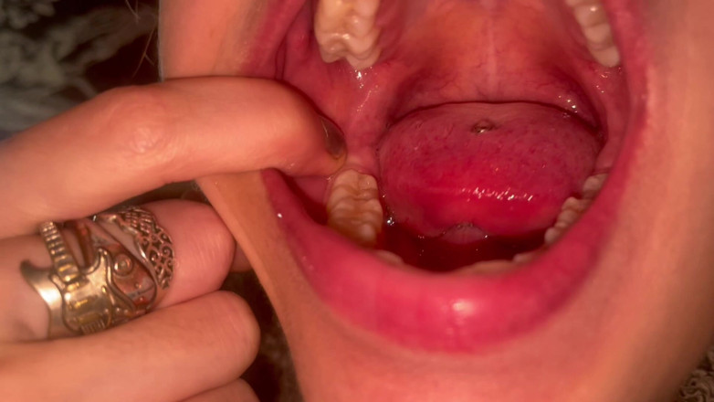 Glitterqueen1999: Turul gurii fără machiaj dinți numărați uvula check amigdalele