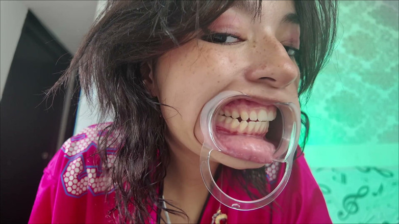 KiyuSweetCrazy: Cheeks Pulled Apart Teeth Exposed