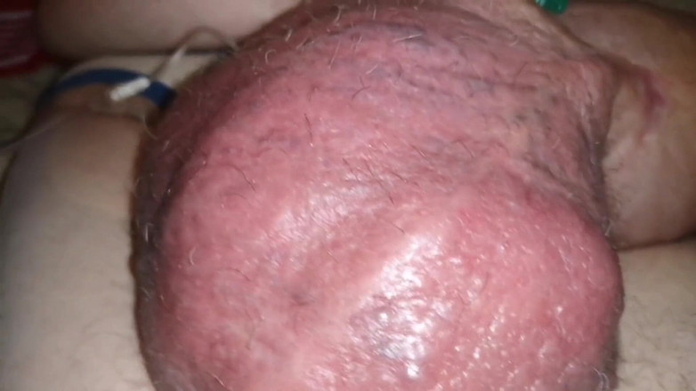 Monster_Meat_: Po napumpování se znovu naplní glukózou