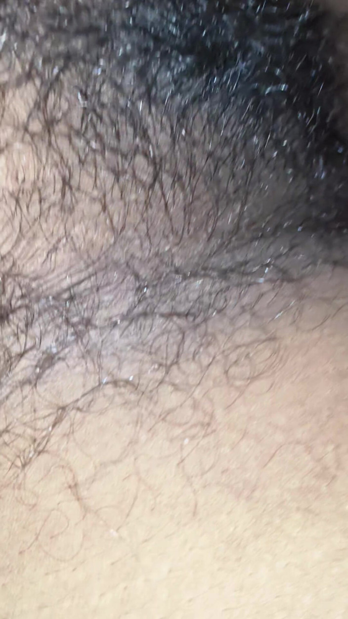 Suman818: Una figa pelosa