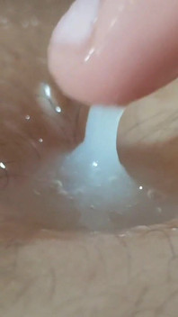 Buricul adânc se transformă într-un rezervor de spermă.