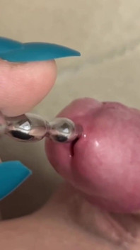 Uretrální vložení