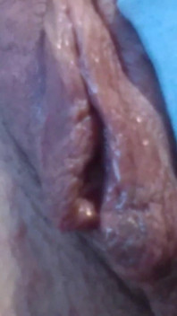 Labbra carnose primo piano molto bagnate