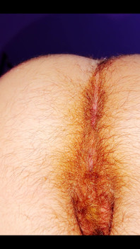 Hairy Butt of a 5-month Pregnant Woman