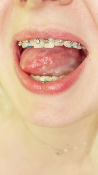 Eating in Braces, Food Fetish Video Devour
