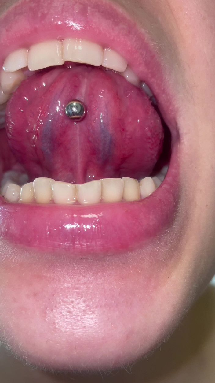 Glitterqueen1999: Mund-tour kein make-up, zähne, zunge uvula Mandeln überprüfen