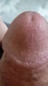 My Dick