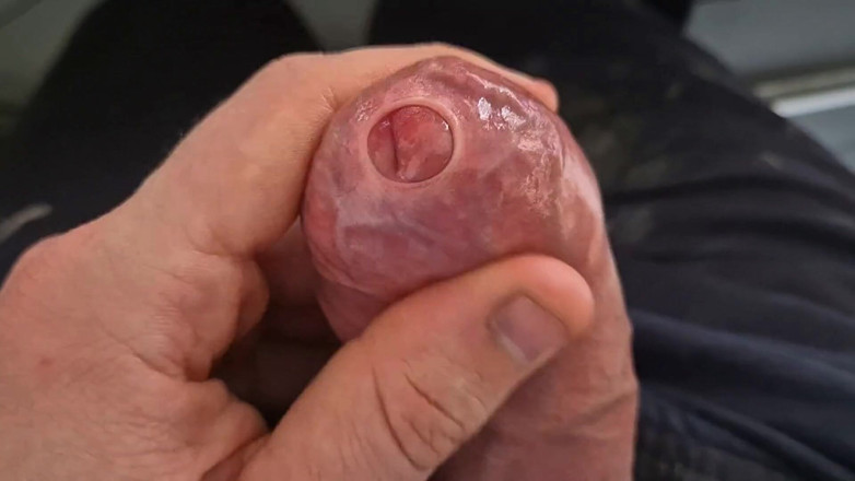 GloomyChase977: Ayah besar yang belum disunat. Mainin kulup phimosis yang sempit,...