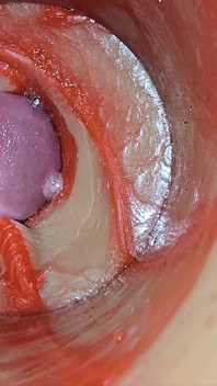 Female Insemination - внутренняя камера снимает глубокую мужскую огромную эякуляцию