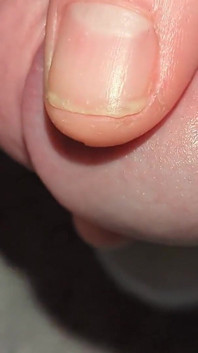 Closeup Hole Leaking and Swallowing Cum Dressed in Lingerie Stocking Filling Cup and Swallowing Own Sperm Wanking Uncut