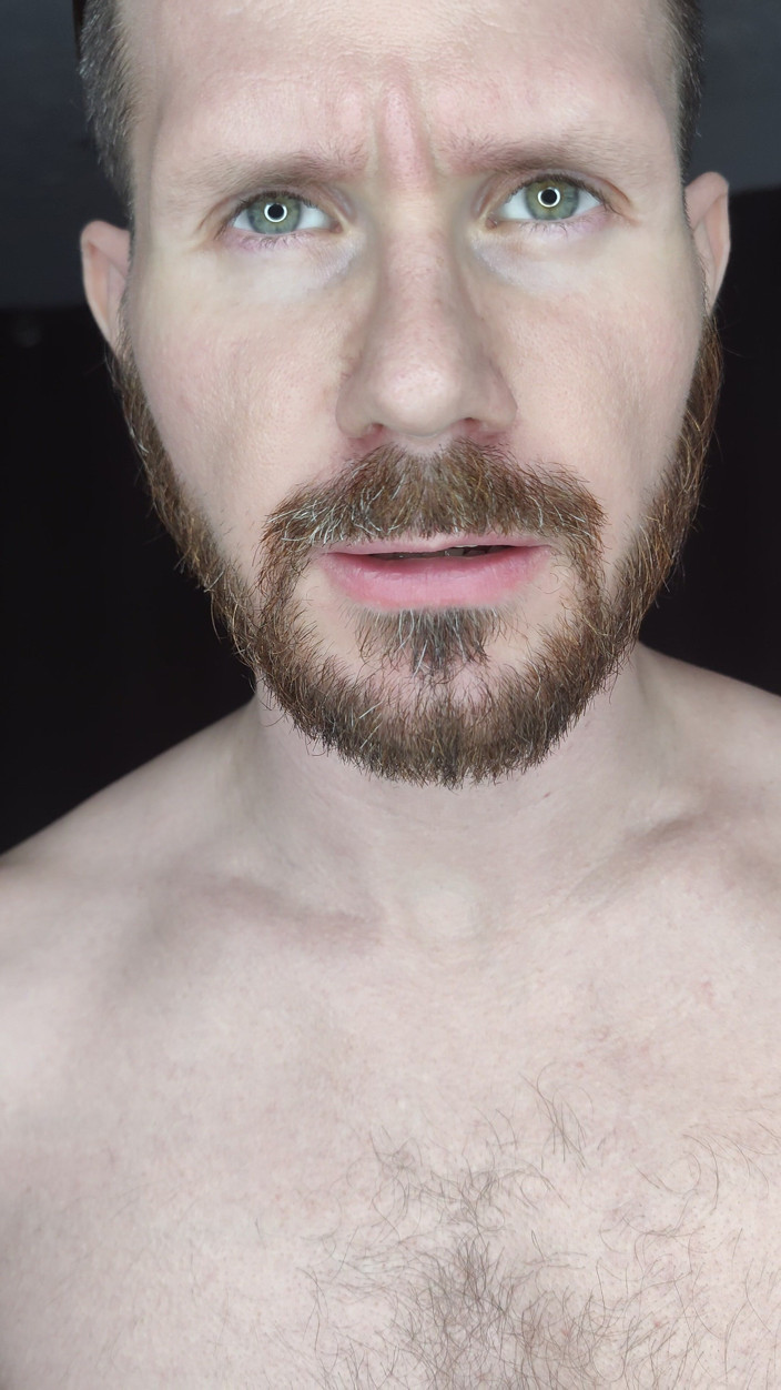 Albino Adonis: Vítej