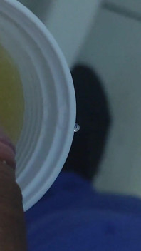 Homemade Method for Freezing the Penis.