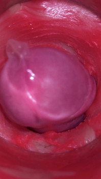 Kamera dalam memek: memeknya dicrot sperma banyak bangek! Asmr Internal Terbaik dalam 4k Lebih Banyak Sperma