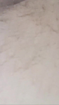 Anal Gap