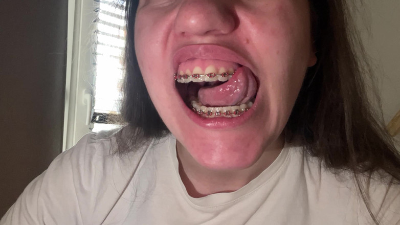 NicoleRay: Lingând aparatul dentar cu limba