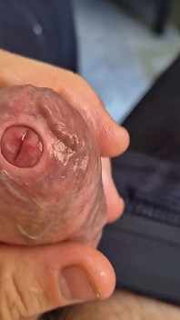 Phimosis Stepdaddy. Ight Foreskin Stroking Until I Leak Everywhere