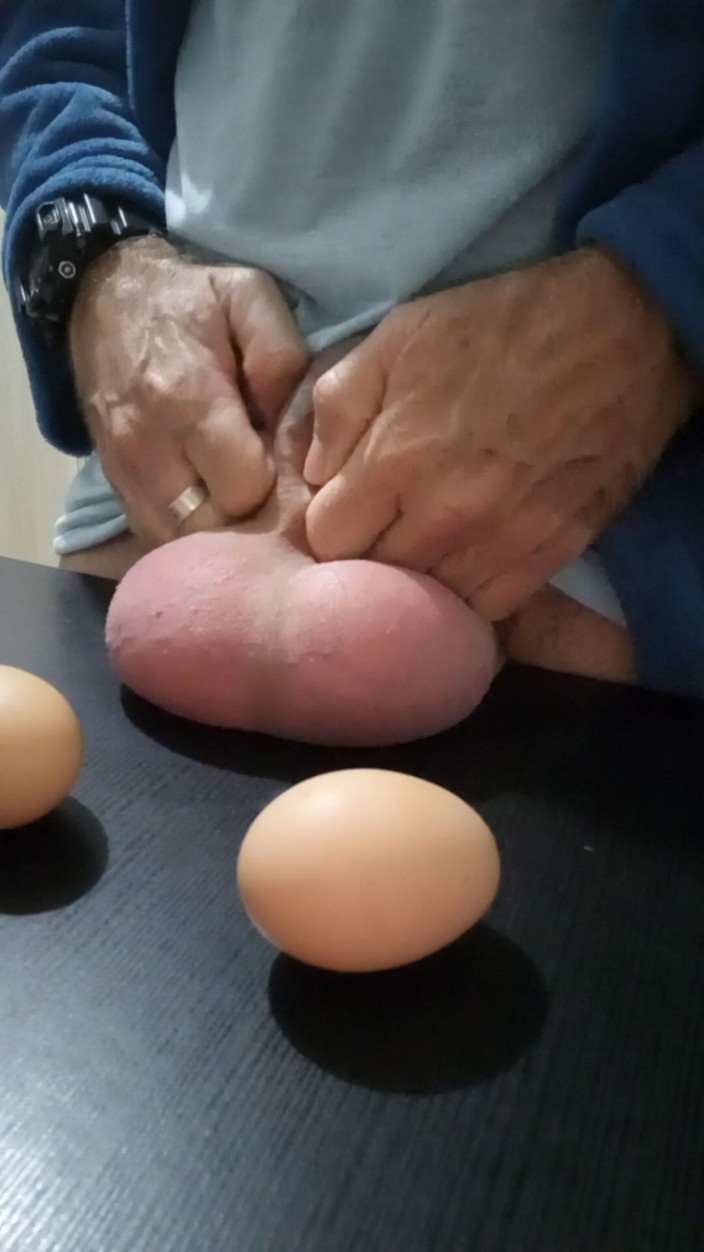 Lion big balls: Measuring and Eggs Comparing