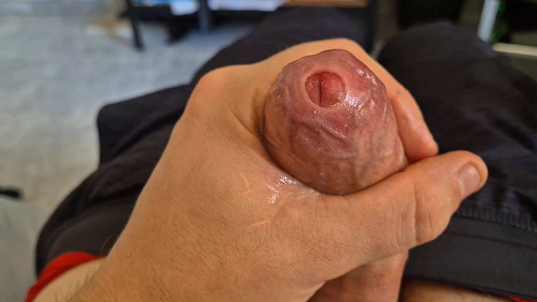 GloomyChase977: Phimosis Daddy. Ight Foreskin Mengusap Sehingga Saya Bocor Di Merata-rata