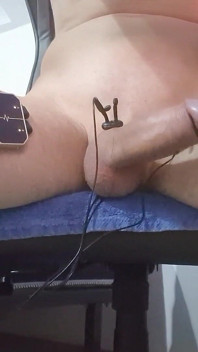 E-stim Hfo