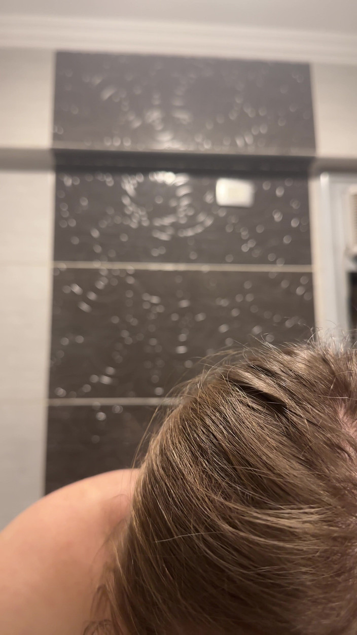 SweetLucy96: Het blondin med tandställning