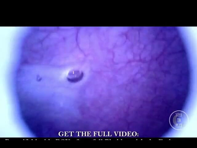 Lina Free: 632750815664152576