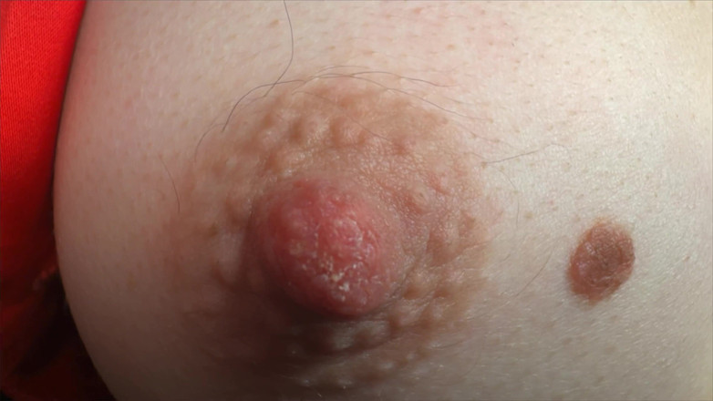 Skinny_lady69: 超级特写