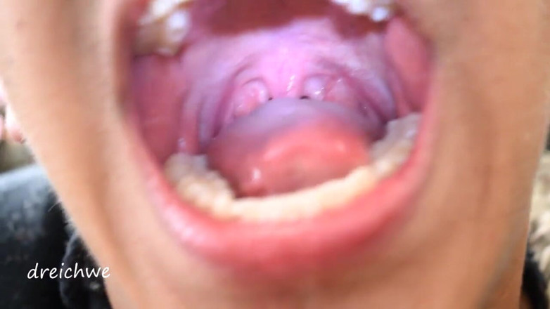 Dreichwe: Uvula фетиш в рот