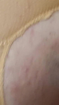 Julie Cunningham Bb Pussy Fuck, Spotty, Not Shaved Weel & Hairy