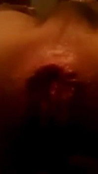 My First Anal Prolapse Video That I Shot