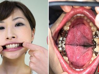 Japan Fetish Fusion: 歯の検査クロニクル:日高ユアの謎めいた口腔領域に飛び込む