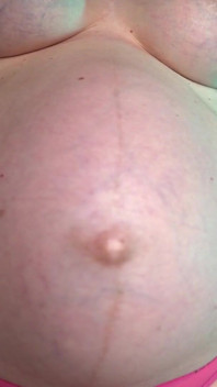 Spit From Pregnant