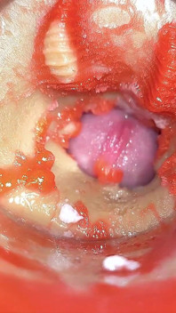 Kamera seks anal serviks pov, cewek mungil ini dientot sama pasangan raksasa ''', crot di dalam dan crot di dalam - asmr