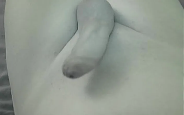 Wibblewang: Catheter Removal