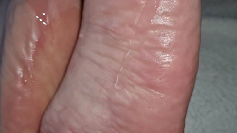 Alter: Caro foot.