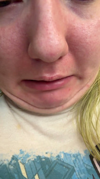 Chin Faces