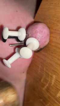 Thumtacks duelen