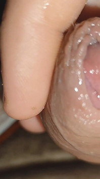 Silent Purge of Straight Scrotal Fluid.