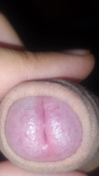 Dick Erection