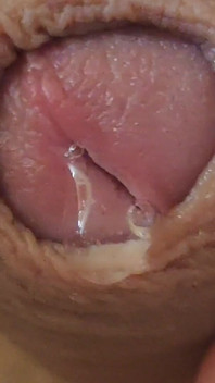 Large Foreskin and Balls in Striking Close-up.
