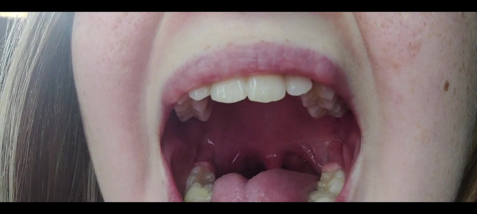 RavenHearth666VIP: Boğaz fetişi