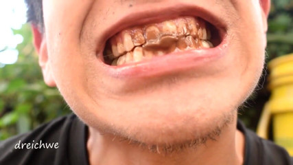 Dreichwe: Chocolate on the teeth