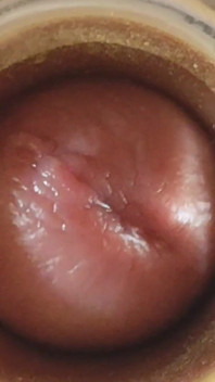 Boy Close up Tight Uncircumcised Glans Excited