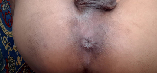 Che: Un Indien se fait doigter par un trou du cul...