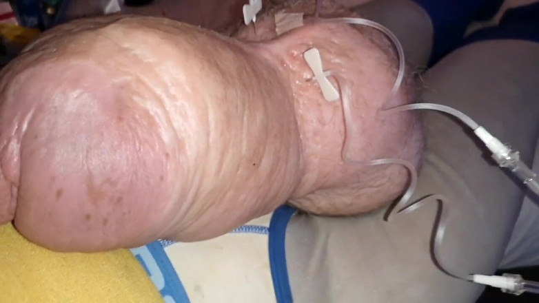 Monster_Meat_: Cockzilla se vrací po přidání 2litr glukózy