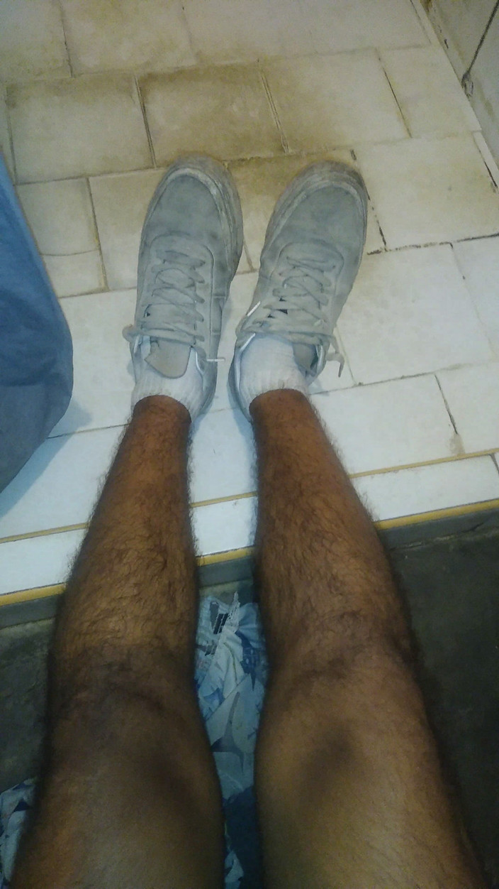 AlexAlejandro13: Picioare!