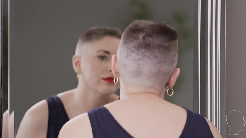 Euro Bald: Ronii 2