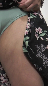 Çiş çaresizliği snippet